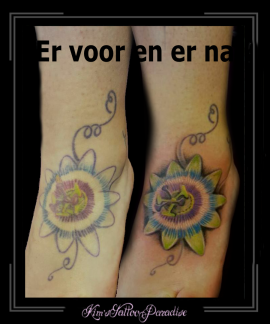 coverup voet