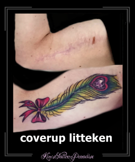 litteken coverup bovenarm